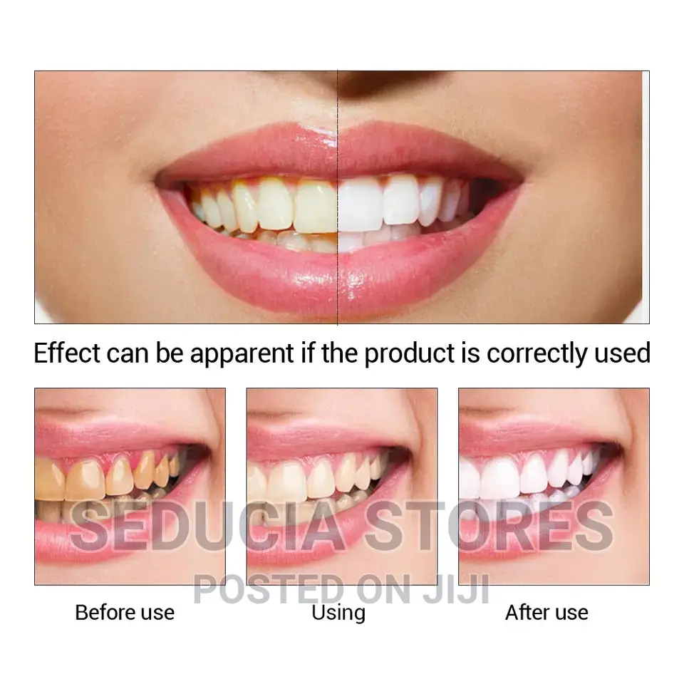 Lanbena Teeth Whitening Essence